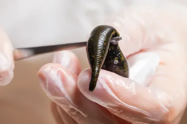 Czy pijawki mogą wspierać skuteczność przeszczepów skóry?